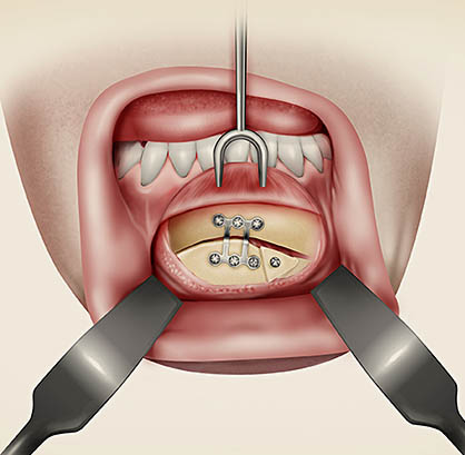 ilustración de cirugía